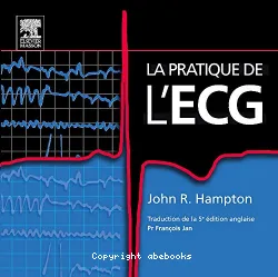 La pratique de l'ECG