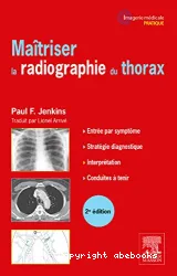 Maîtriser la radiographie du thorax