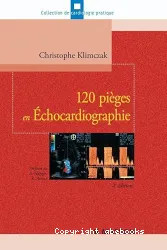 120 pièges en échocardiographie