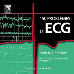 150 problèmes d'ECG